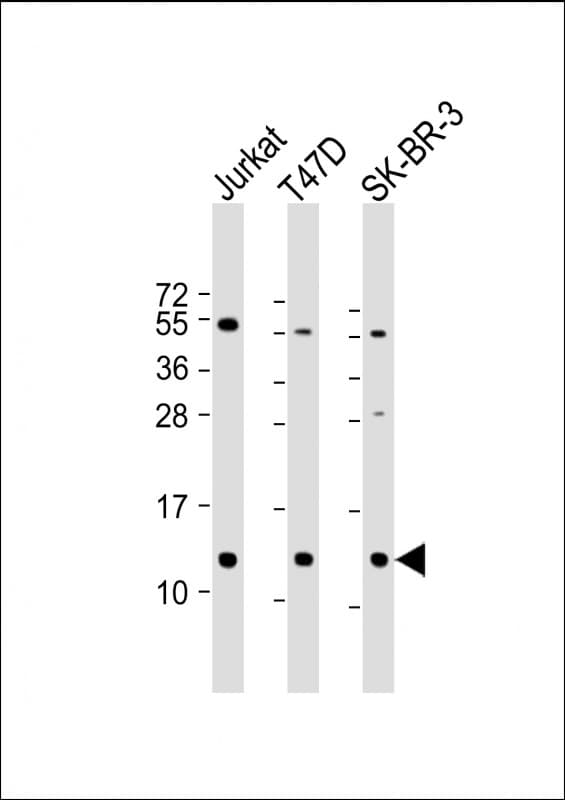 TFF1 / pS2 Antibody (Internal)