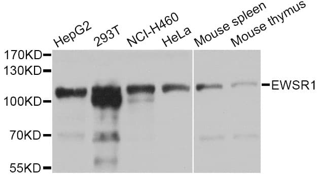 EWSR1 / EWS Antibody