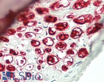 IHC-plus™ ASAP2 / DDEF2 Antibody (Internal)
