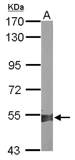 RALDH2 / ALDH1A2 Antibody (aa278-518)