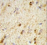 Polyclonal Rabbit anti-Human QDPR / DHPR Antibody (aa218-243, IHC, WB)