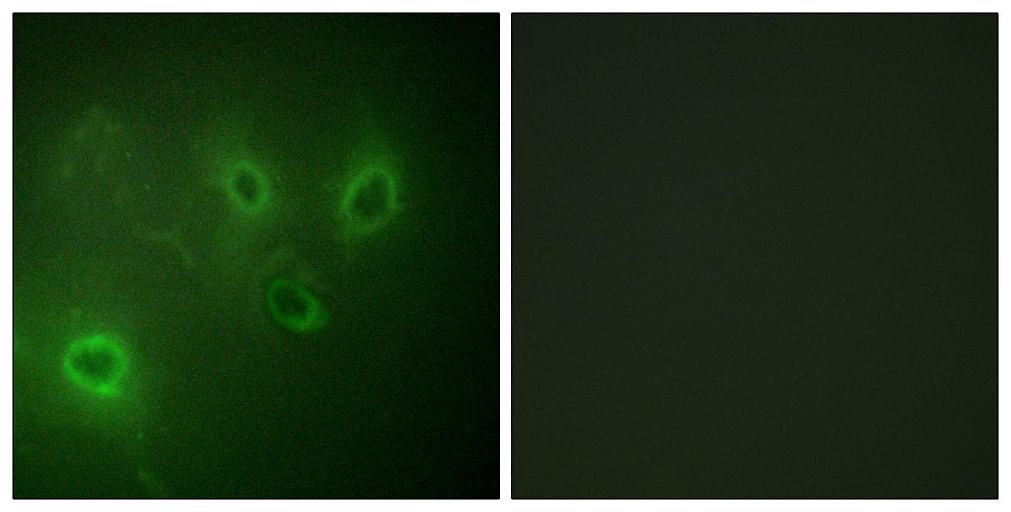 ITPR1 / IP3 Receptor Type 1 Antibody