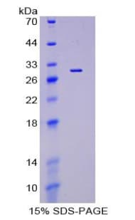 Rat PODXL / Podocalyxin Protein (Recombinant His, N-Terminal)