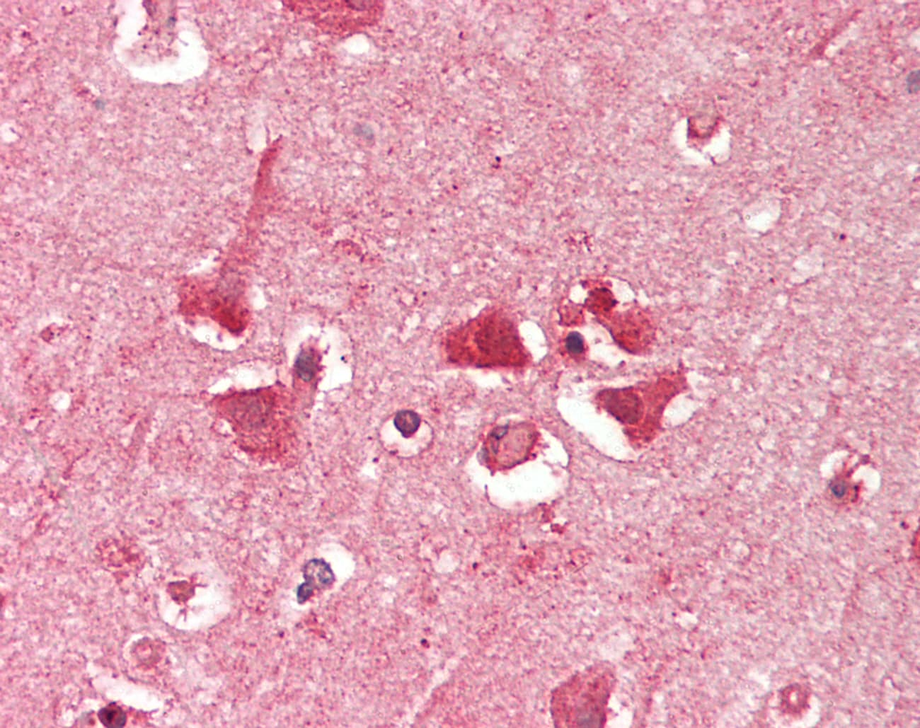 RPS3A / Ribosomal Protein S3A Antibody (aa35-84)
