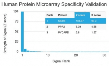MSH6 Antibody (clone MSH6/2111)