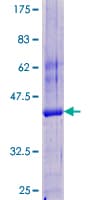 Human Tyrosine Aminotransferase Protein (Recombinant GST)