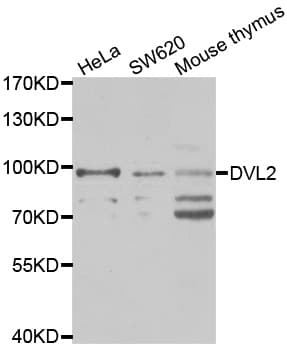 DVL2 / Dishevelled 2 Antibody