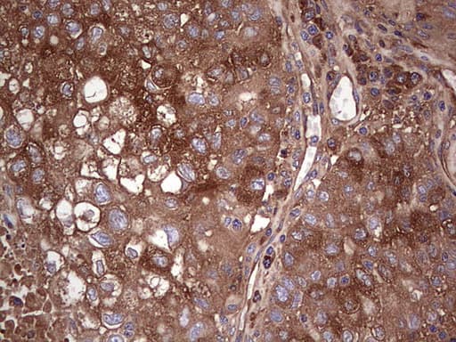GARS / Glycyl tRNA Synthetase Antibody (clone OTI6C5)