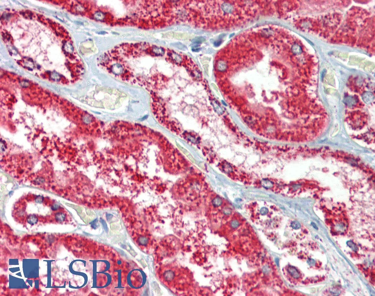 IHC-plus™ HSPD1 / HSP60 Antibody (clone Mab-11-13)