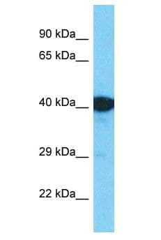 EGR2 Antibody (aa166-215)