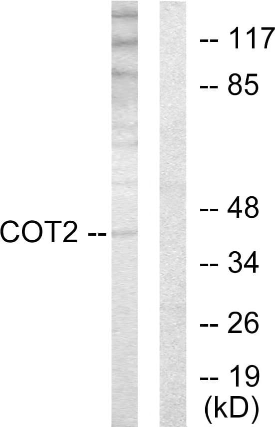 COUP-TFII / NR2F2 Antibody (aa1-50)