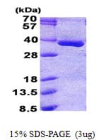 Human PGP Protein (Recombinant His)