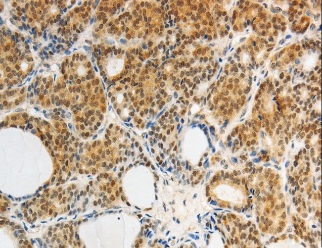 AKR1A1 Antibody