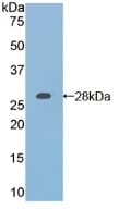 RARA / RAR Alpha Antibody (aa237-459)