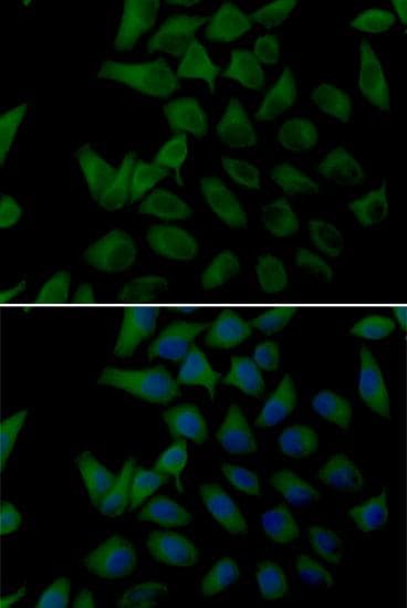 Polyclonal Rabbit anti-Human PLOD2 Antibody (IF)