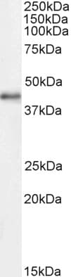 CDK9 Antibody (C Terminus)