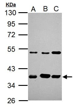 IHC-plus™ ARA9 / AIP Antibody (Internal)