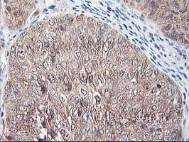 ALS2CR1 / NIF3L1 Antibody (clone OTI1F6)