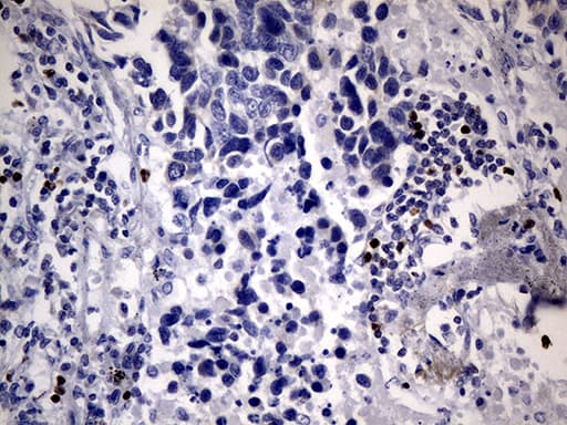 FOXP3 Antibody (clone OTI3D1, Carrier-free)