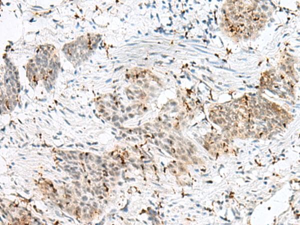 Polyclonal Rabbit anti-Human PLCL2 Antibody (IHC)