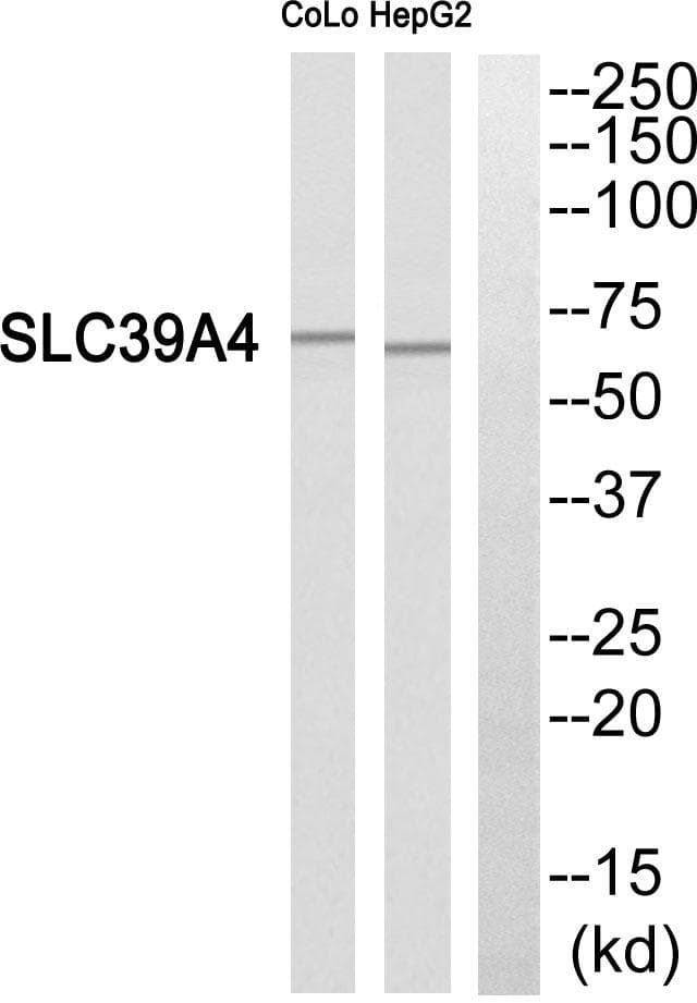Polyclonal Rabbit anti-Human SLC39A4 / ZIP4 Antibody (WB)