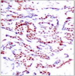 Polyclonal Rabbit anti-Human ATF2 Antibody (IHC, WB)
