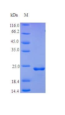 Human FGF9 Protein (Recombinant)