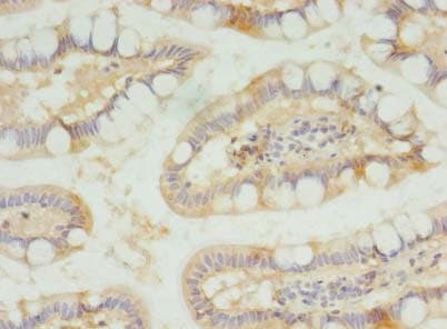 SLC23A1 / SVCT1 Antibody