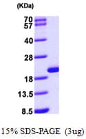 Human GMF Beta / GMFB Protein (Recombinant His)