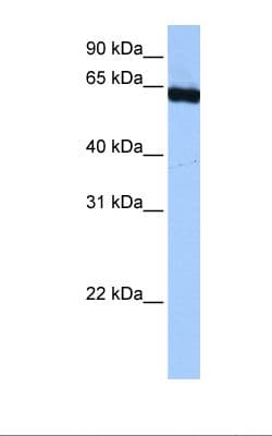 Polyclonal Rabbit anti-Human PUF60 Antibody (C-Terminus, IHC, WB)