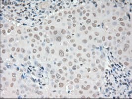 VEGFA / VEGF Antibody (clone OTI4E3)