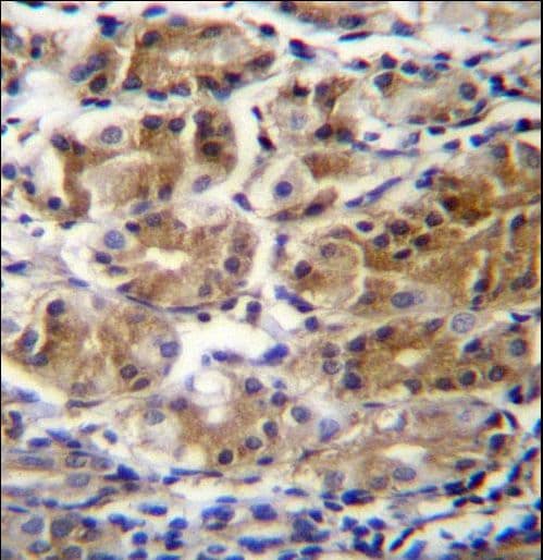 Polyclonal Rabbit anti-Human PDPR Antibody (aa821-850, IHC, WB)