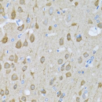 Polyclonal Rabbit anti-Human MAPK10 / JNK3 Antibody (IHC, WB)