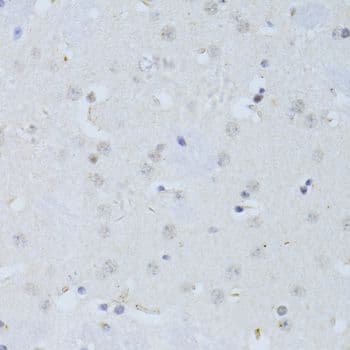 POLR2A / RNA polymerase II Antibody