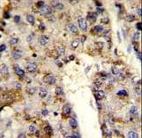 HNRNPL / hnRNP L Antibody (aa249-277)