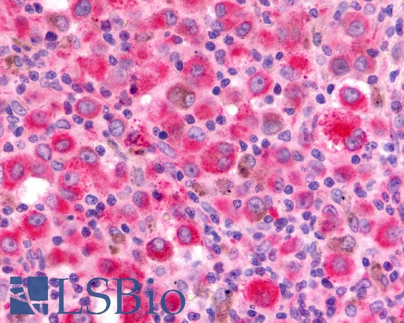 IHC-plus™ CXCR2 Antibody (N-Terminus)