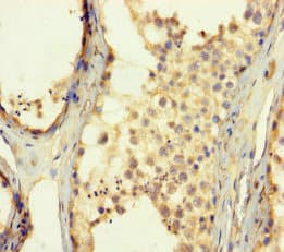 Polyclonal Rabbit anti-Human ZNF454 Antibody