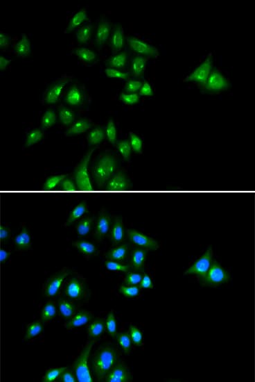 PHC3 Antibody
