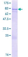 Human BTBD3 Protein (Recombinant GST)