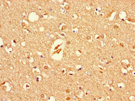 Polyclonal Rabbit anti-Human KIAA1409 / UNC79 Antibody (IHC, IF)