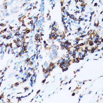 SPN / CD43 Antibody