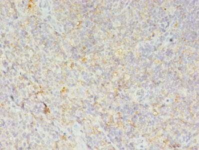 IHC-plus™ Polyclonal Rabbit anti-Human HLA-DRB4 Antibody (IHC, WB)