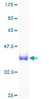 Human UBE2D3 / UBCH5C Protein (Recombinant GST)