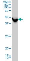 IHC-plus™ SHMT / SHMT1 Antibody (clone 4F9)