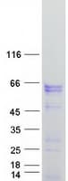 Human FOXC2 Protein (Recombinant Myc-DDK (Flag))