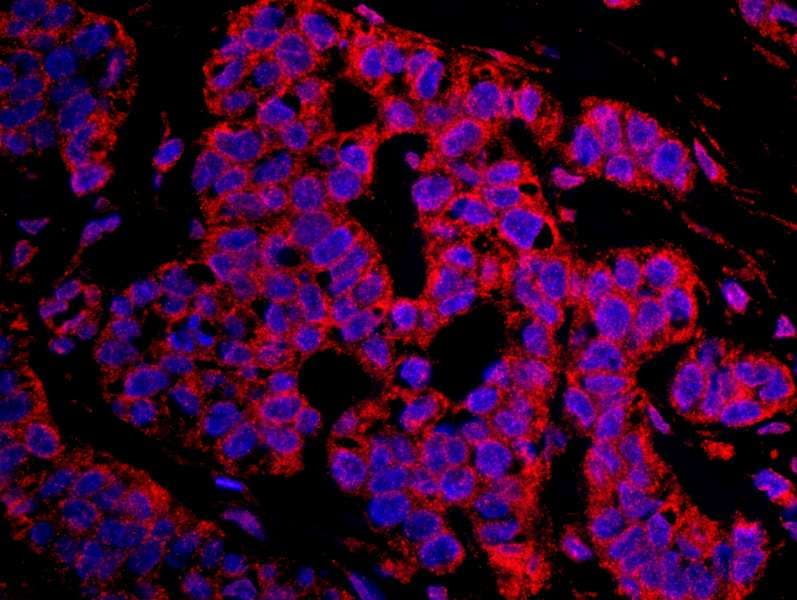 CASC3 / MLN51 Antibody (aa653-703)