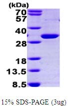 Human PPARG / PPAR Gamma Protein (Recombinant His)