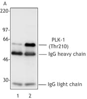 IHC-plus™ PLK1 / PLK-1 Antibody (phospho-Thr210, clone 2A3)