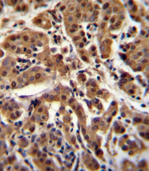 AKT1 Antibody (aa428-457)