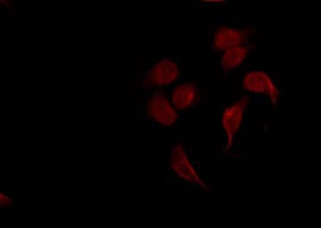 Polyclonal Rabbit anti-Human SYK Antibody (phospho-Tyr323, IHC, IF, WB)
